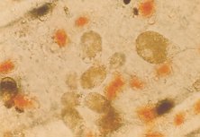 Oodinium sp.